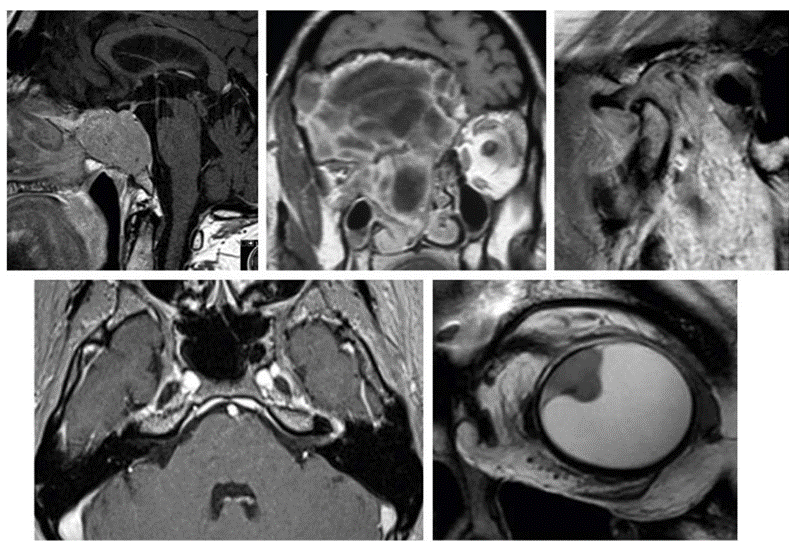 Erasmus Course on Head and Neck MRI 2027