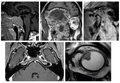 Erasmus Course on Head and Neck MRI 2027