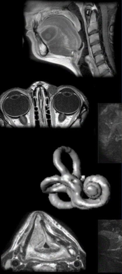 Erasmus Course on Head and Neck MRI 2026 - Fully booked
