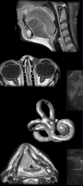 Erasmus Course on Head and Neck MRI 2026 - Fully booked