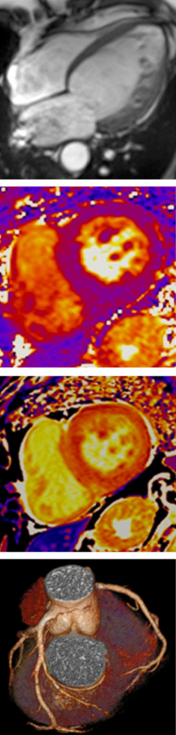 Erasmus Course on Cardiovascular MRI + CT 2027