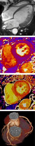 Erasmus Course on Cardiovascular MRI + CT 2027