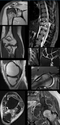 Erasmus Course on Musculoskeletal MRI (comprehensive course) 2026
