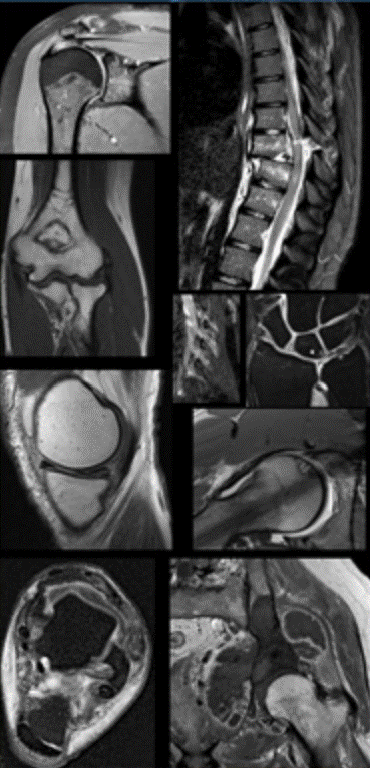 Erasmus Course on Musculoskeletal MRI (comprehensive course) 2026