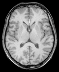 Erasmus Course on Neuro MRI 2027